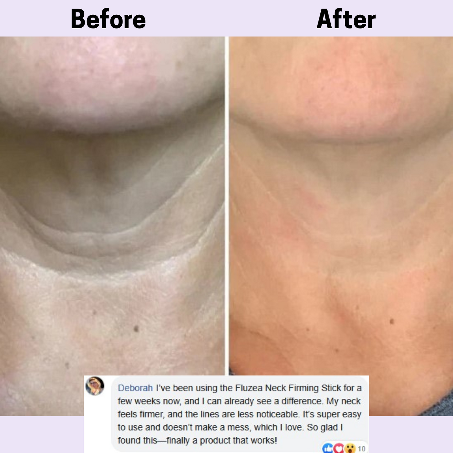 Fluzea Neck Firming Stick