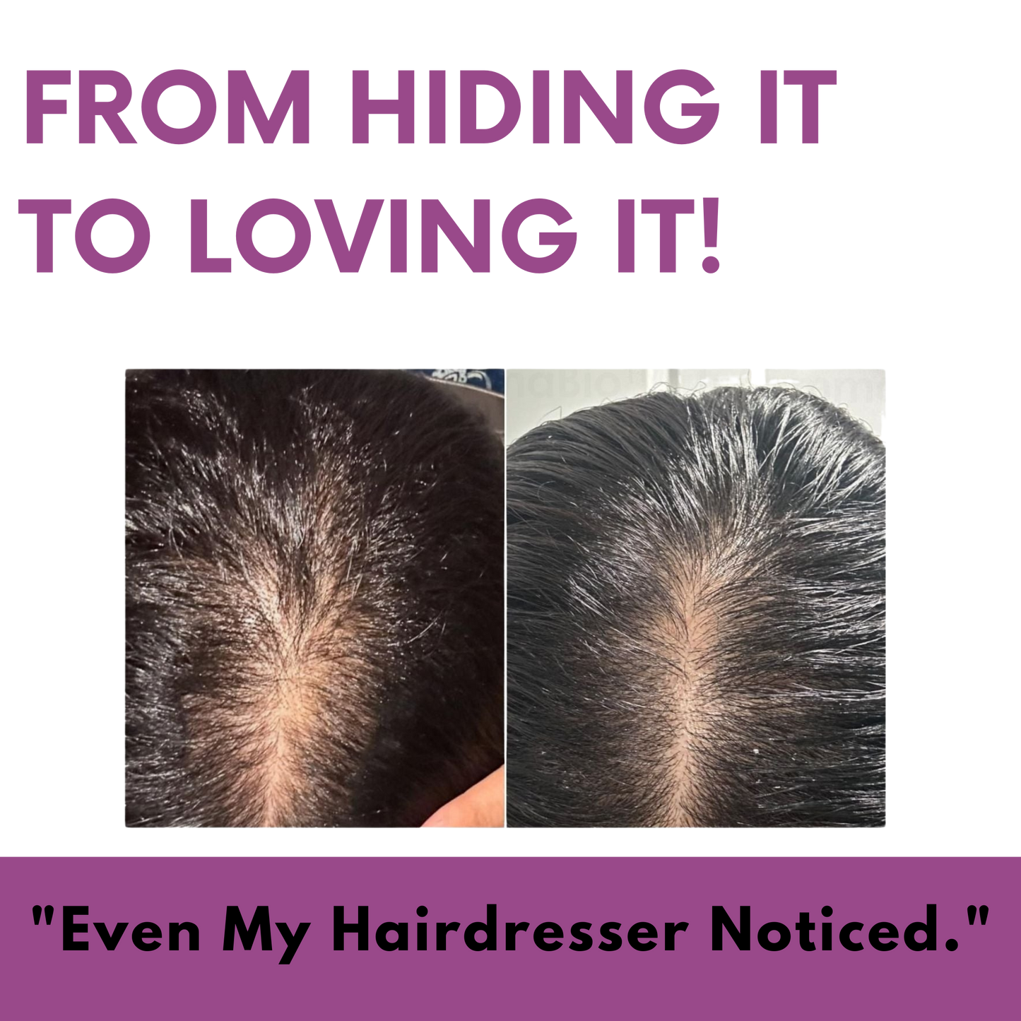 Mirvea Renew - Hair Growth Gummies