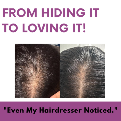 Mirvea Renew - Hair Growth Gummies