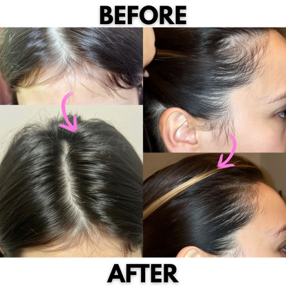 Mirvea Renew - Hair Growth Gummies